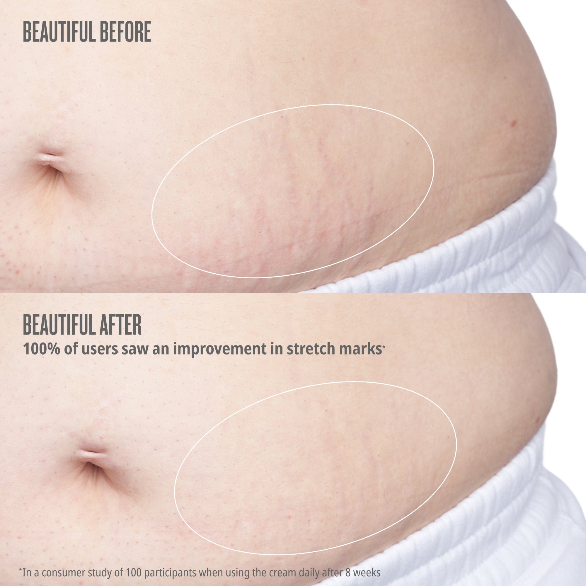 Bum Bum Body Firmeza Oil - Image 3